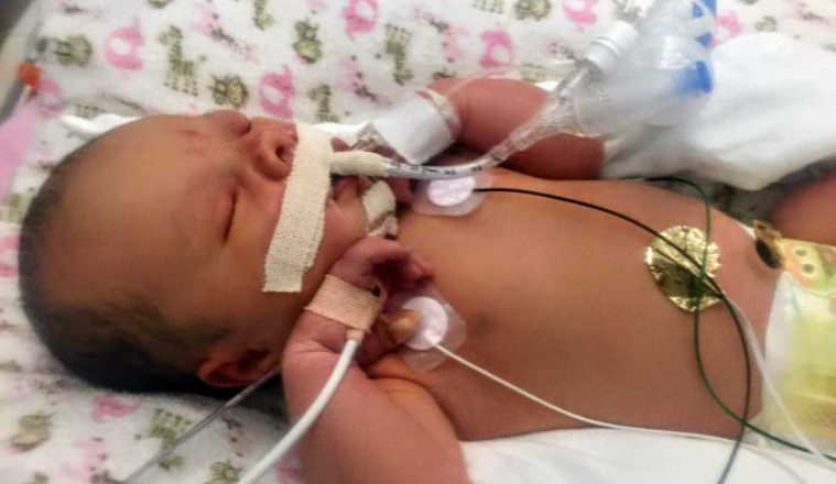 3-годишната ми дъщеря има Алцхаймер — Това е нашата история